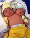 2 Two Headed mutated baby radiation Chernobyl Fukushima Nuclear radioactive fallout