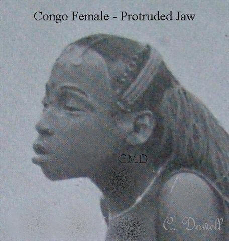 Image of Congo female with protruded jaw African descendent